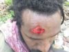 Four protesters allegedly shot by rubber bullets when commemorating Mako Tabuni’s death